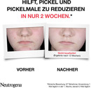 Bild 4 von Neutrogena Anti-Pickel+ AHA/PHA/BHA Peeling Serum