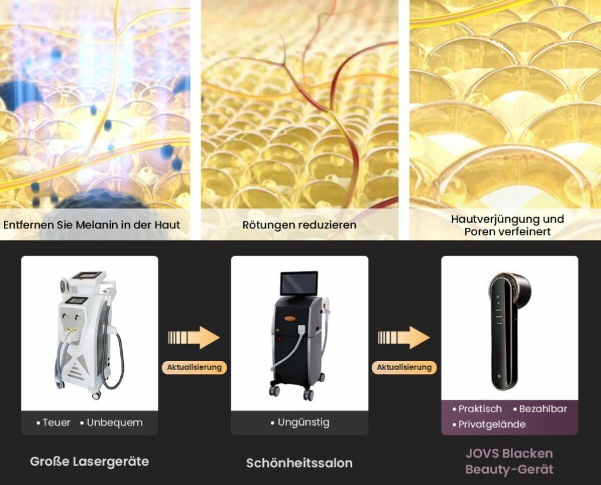 Bild 3 von JOVS Kosmetikbehandlungsgerät Anti-Aging, verringern Pigmentflecken & Hautrötung,Gesichtspflege, Drei Models : BRIGHTENREDNESSWHITEN
