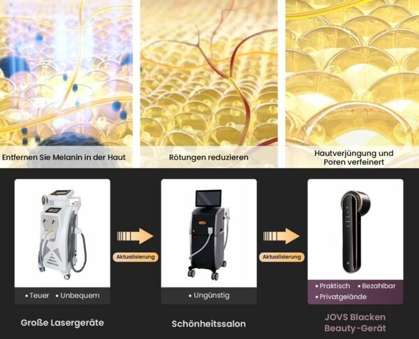 Bild 3 von JOVS Kosmetikbehandlungsgerät Anti-Aging, verringern Pigmentflecken & Hautrötung,Gesichtspflege, Drei Models : BRIGHTENREDNESSWHITEN
