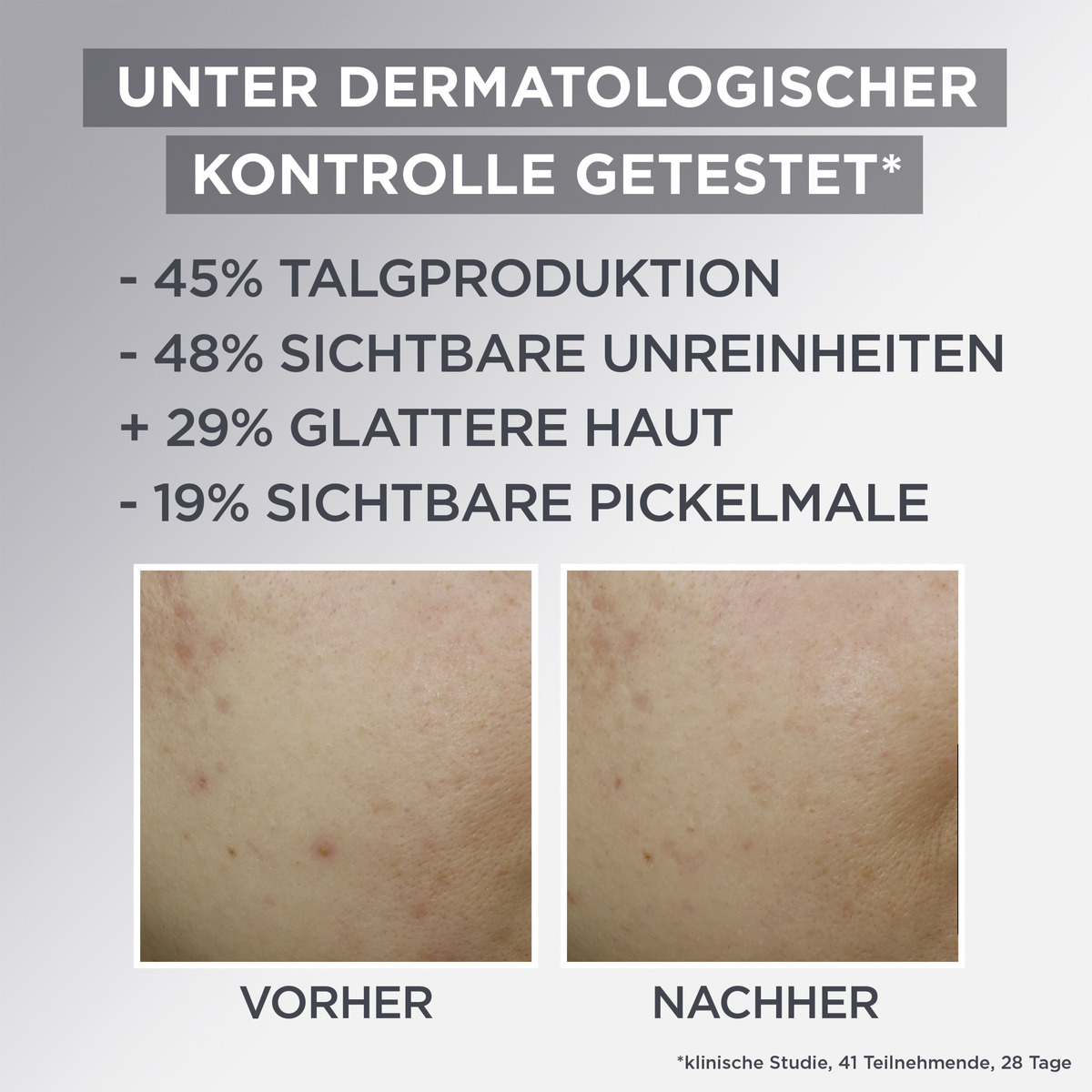 Bild 3 von Garnier SkinActive Hautklar Gesichtscreme 3in1 Mattierende Air Cream