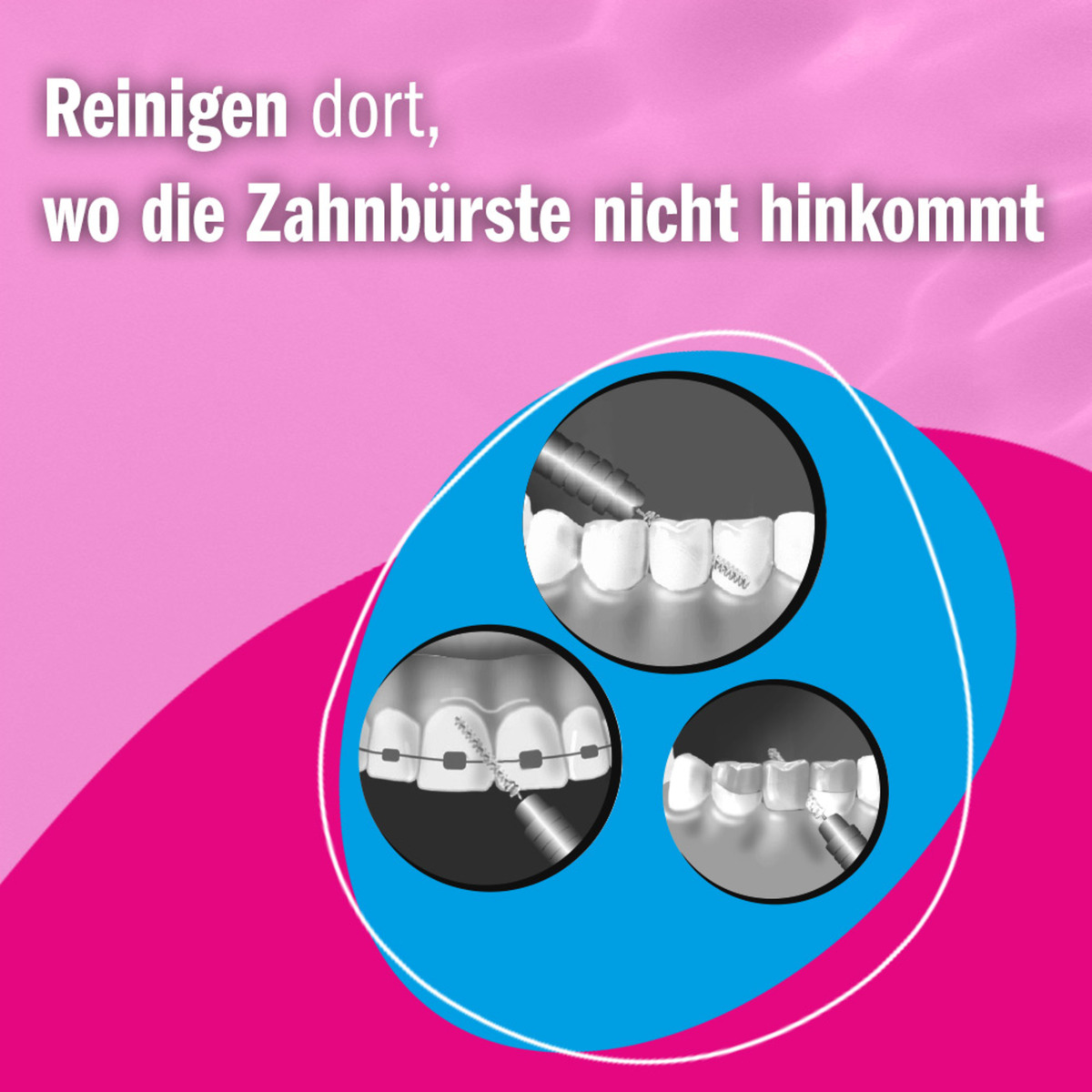 Bild 4 von Prokudent Interdental Bürstchen ISO 3