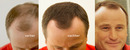 Bild 4 von COVER HAIR Haarverdichtung mit Schütthaar mittelbraun 71.07 EUR/100 g