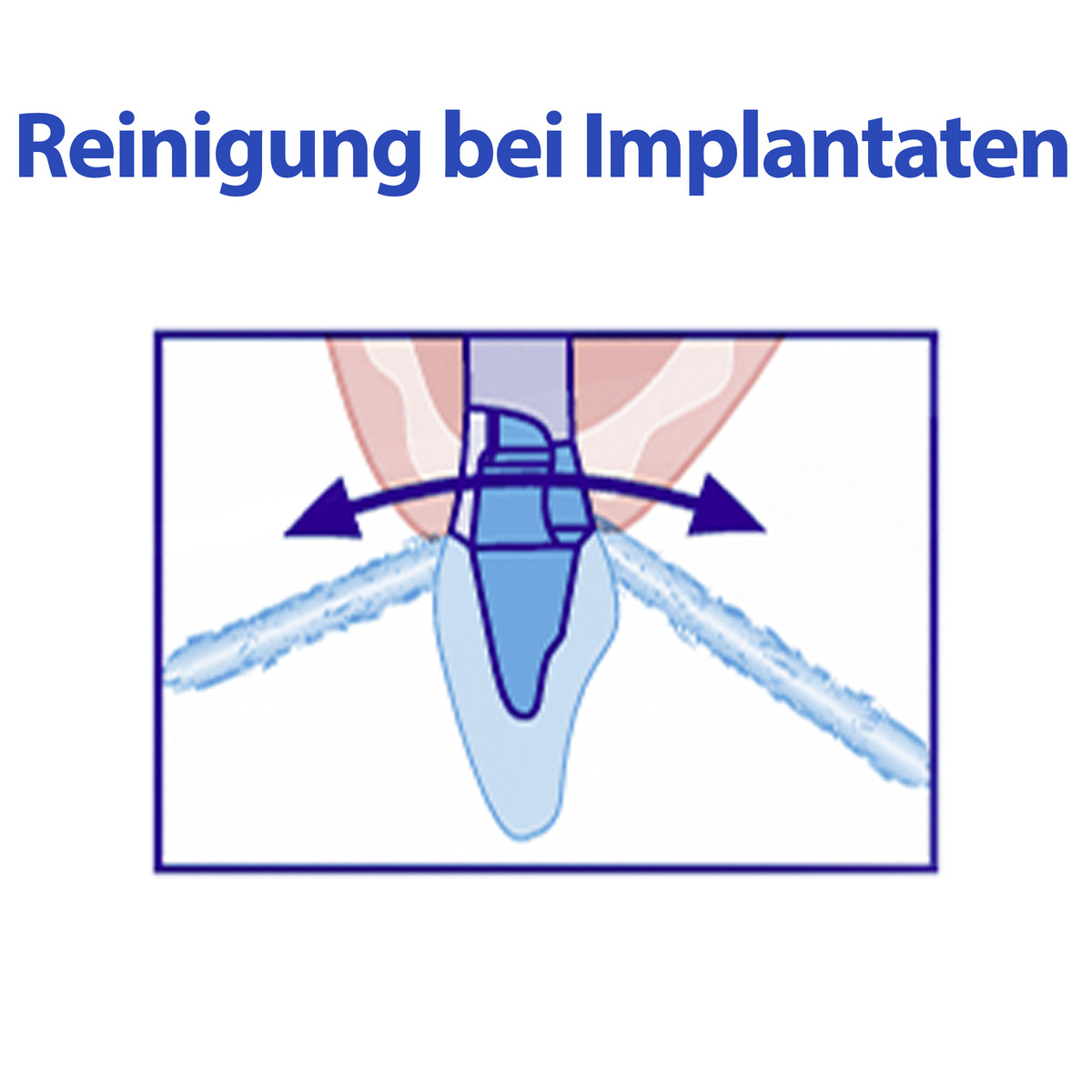 Bild 4 von meridol Spezial-Flauschfäden