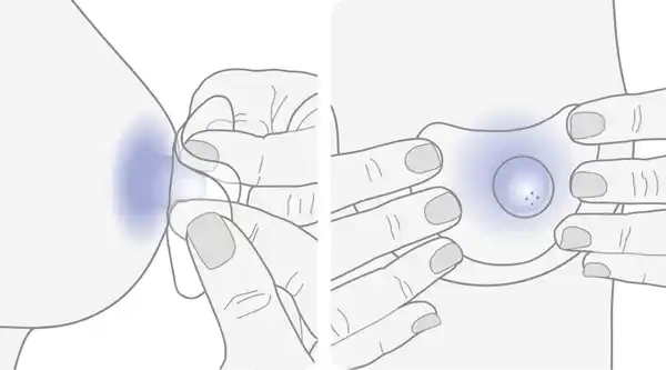 Bild 2 von Lansinoh Stillhütchen 20 mm