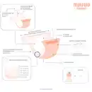 Bild 4 von bambino mio miosolo classic All-in-One Stoffwindel Sanfte Schlafmütze