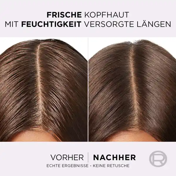 Bild 4 von L’Oréal Paris Elvital Hydra Hyaluronic Pure 72H Feuchtigkeitsspendende Spülung, 250 ml