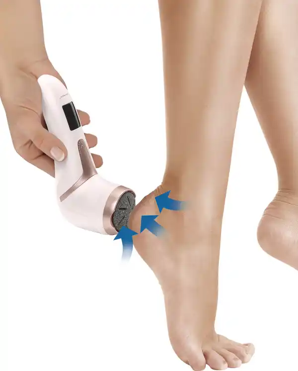 Bild 4 von IDEENWELT Akku-Hornhautentferner