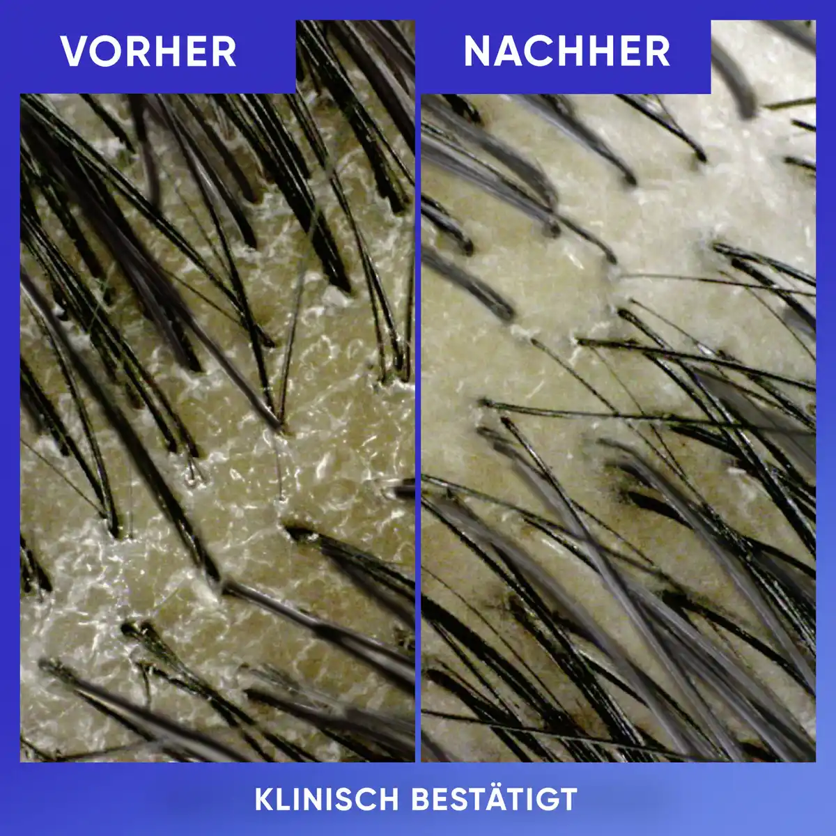 Bild 4 von head & shoulders Anti Schuppen Shampoo Reinigung & Glanz, 300 ml