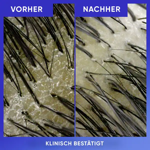 Bild 4 von head & shoulders Anti Schuppen Shampoo Reinigung & Glanz, 300 ml