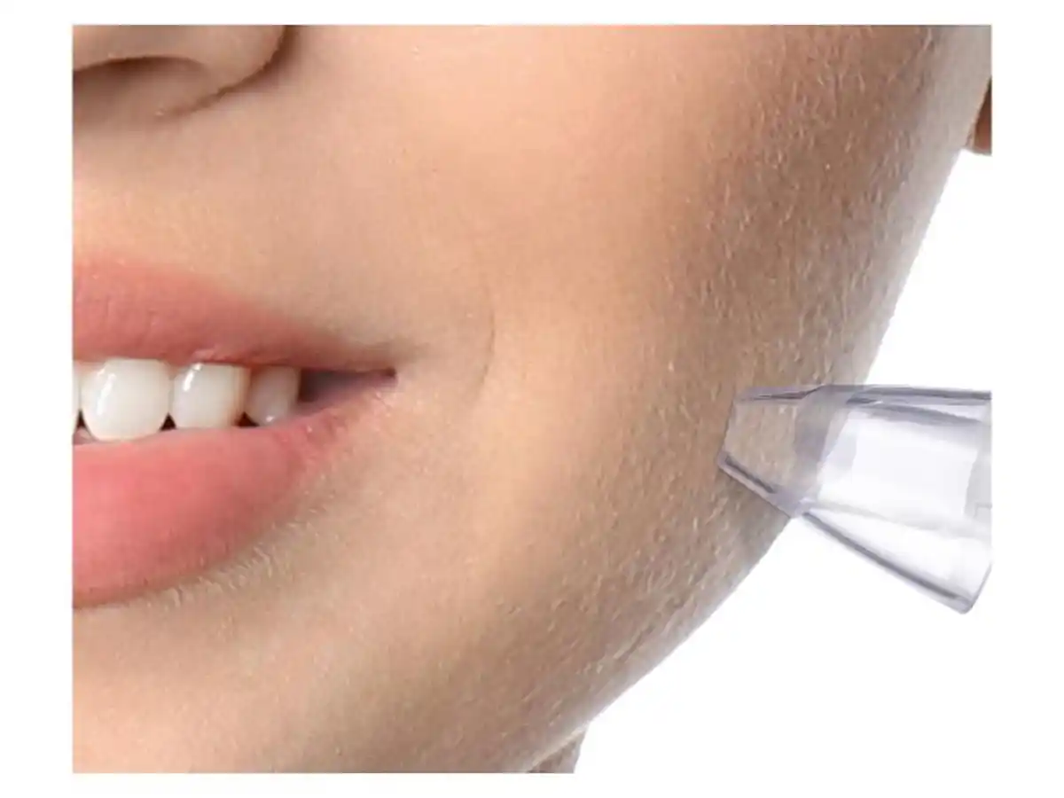 Bild 2 von SILVERCREST® PERSONAL CARE Porenreiniger »SPR 600 B1«, mit 3 Intesitätsstufen