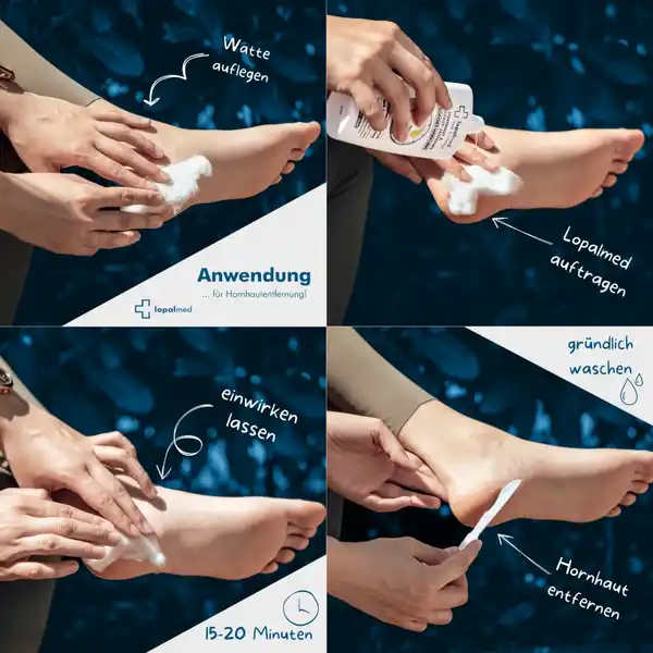 Bild 3 von Lopalmed Hornhaut- & Nagelhautentferner, 200 ml