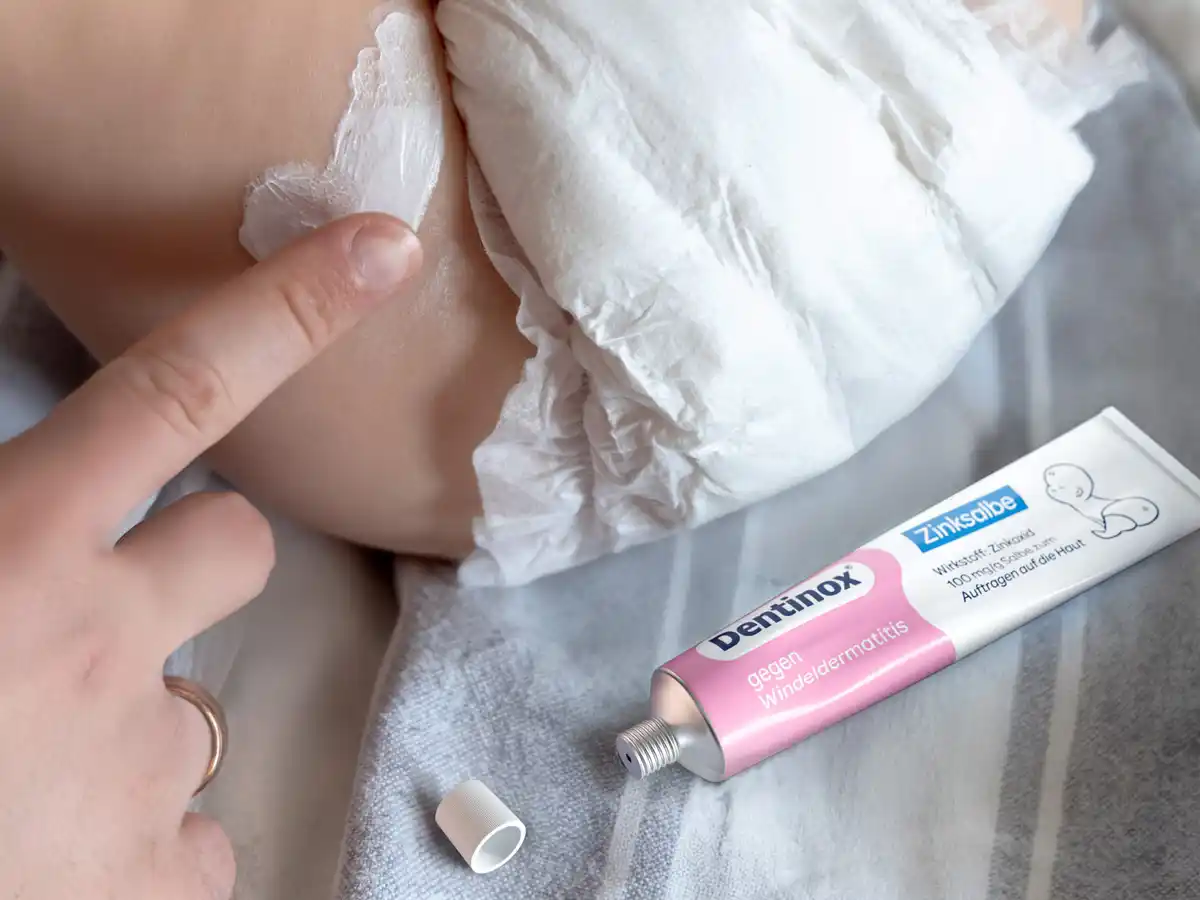 Bild 4 von Dentinox Zinksalbe gegen Windeldermatitis, 45 g