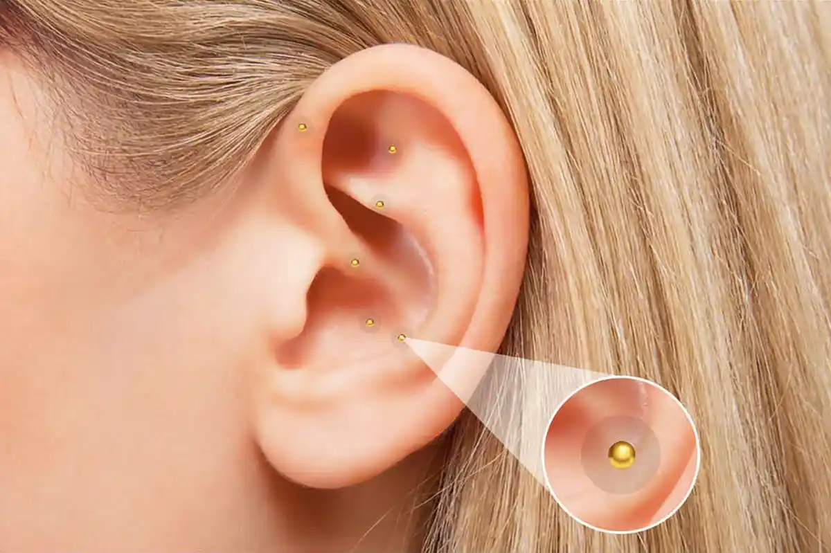 Bild 2 von ZENNY Ohr-Akupressur-Kit »Ear Seeds«, 21-teilig